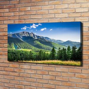 Print pe canvas Dealul din Tatra