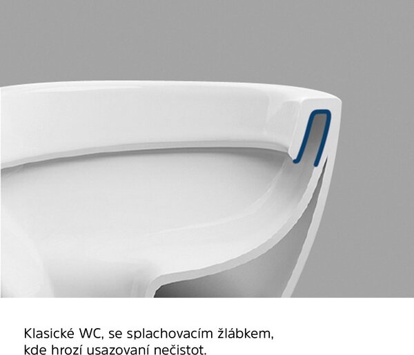 Mereo Mereo, toaletă suspendată cu glugă, FĂRĂ BORDE, 495x360x370, ceramică, incl. scaune CSS115SN, MER-VSD84S2